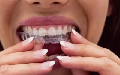 Invisalign Cleveland: Clear Aligner Therapy for Discreet Orthodontic Correction